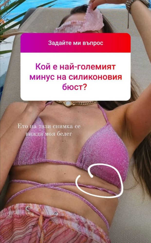 Алекс Петканова призна за силикона и си показа... СНИМКИ 18+